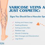 Legs showing varicose veins before laser treatment by Interventional Radiologist.