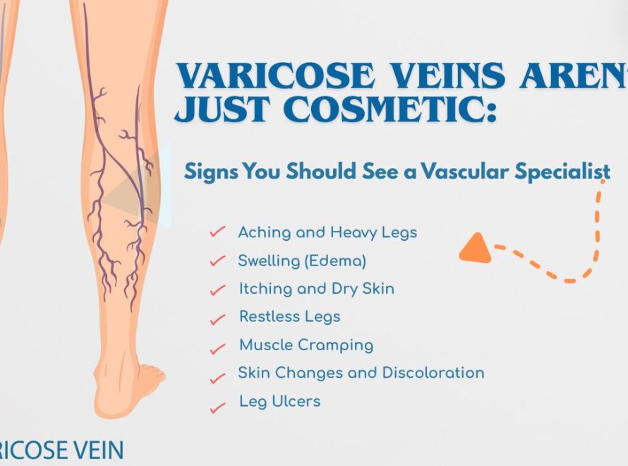 Legs showing varicose veins before laser treatment by Interventional Radiologist.