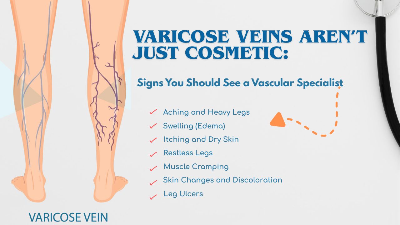 Legs showing varicose veins before laser treatment by Interventional Radiologist.