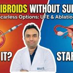 Dr. Akash Bansal comparing Uterine Fibroids treatment options: Microwave Ablation (Cooking) vs Uterine Fibroid Embolization (Starving).