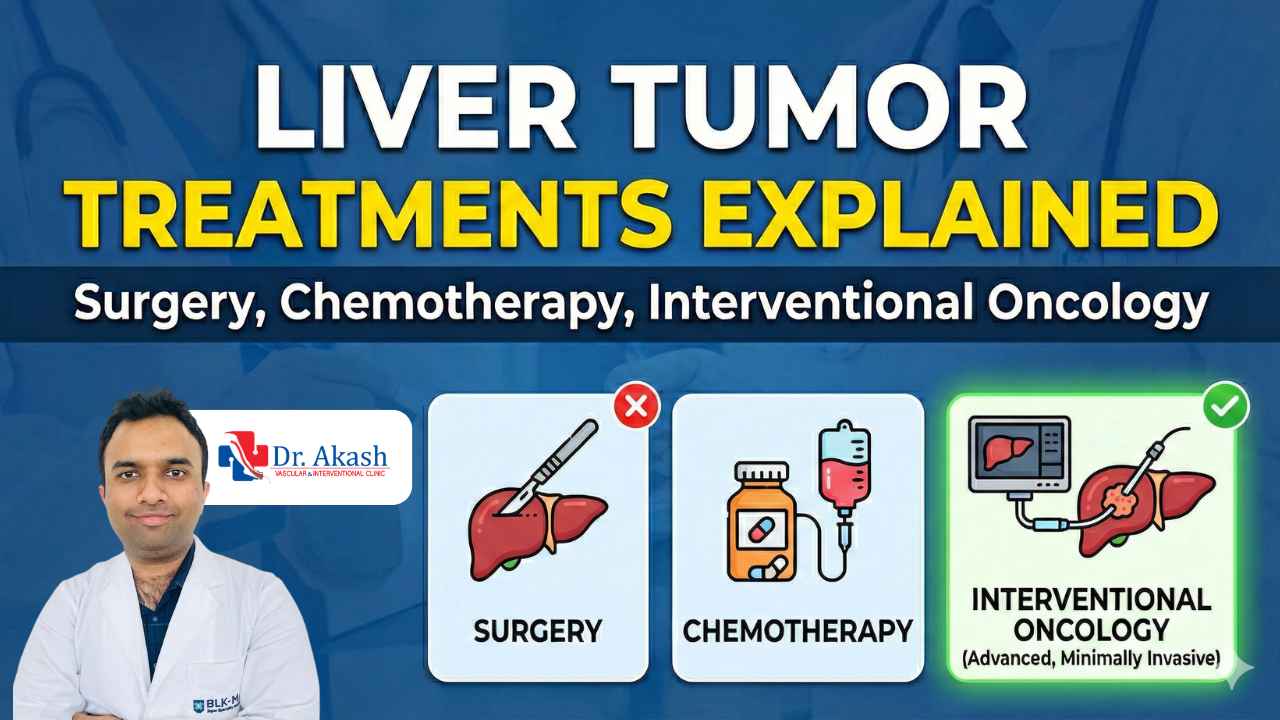 Liver Tumor Treatment in Delhi