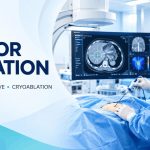 Non-Surgical Image-Guided Tumor Ablation